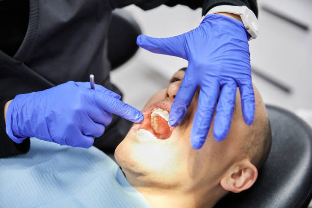 Best Chipped Tooth Repair Near Me  in Hoquiam, WA